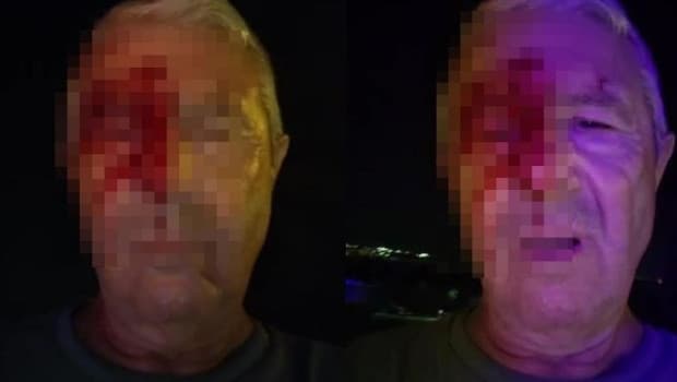 Kocaeli'de haber takibi sırasında muhabire saldırı